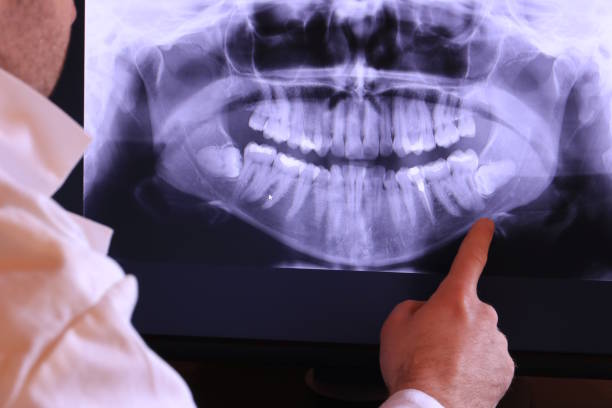 Best Emergency Denture Repair in Willow Park, TX